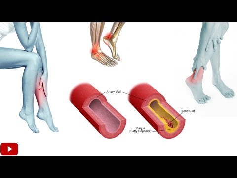 Exercises For Improving Blood Circulation In Legs