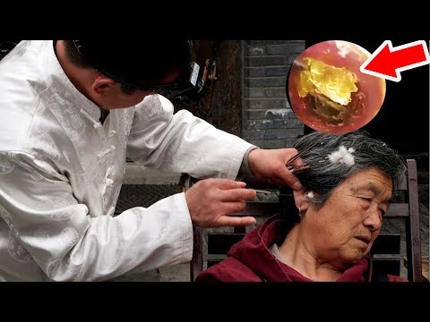Chinese Ear cleaning  with Music Relaxing and stress Relief #71